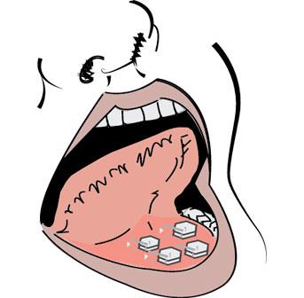 imagen de una boca con pastillas bajo la lengua de misoprostol para abortar